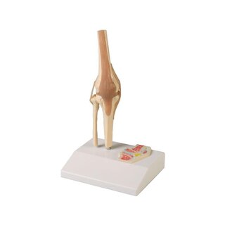 Miniatuurkniegewricht met doorsnede
