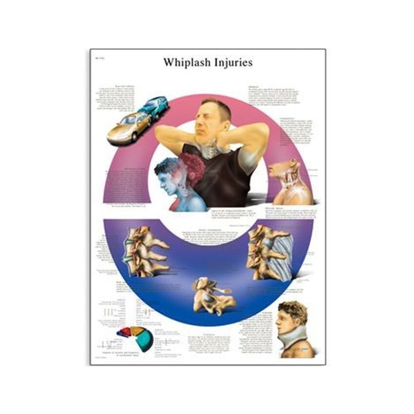 Whiplash letsel 50x67 cm