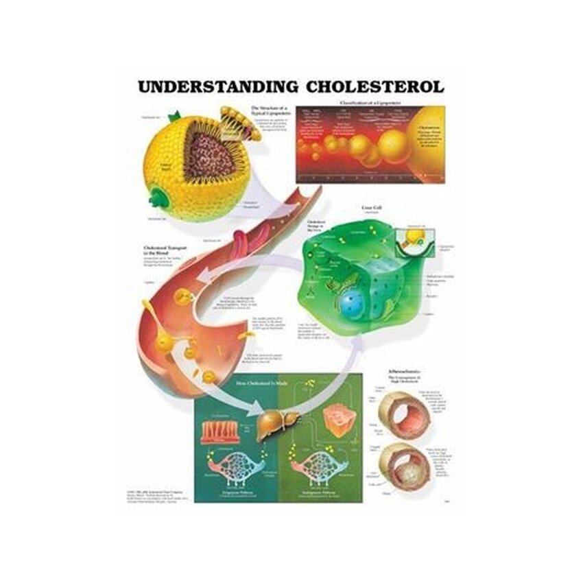 Cholesterol begrijpen gelamineerde poster 51x66 cm