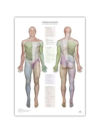 Dermatomen en huidinnervatiegebieden - poster 50x70 cm