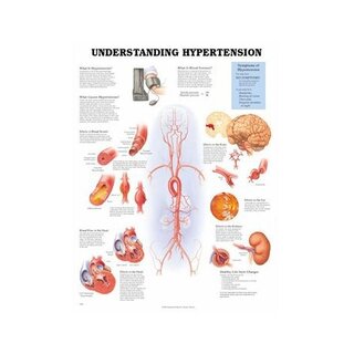 Inzicht in hoge bloeddruk Gelamineerde poster 51x66 cm