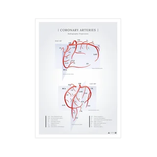 Poster over de kransslagaders van het hart, zichtbaar op röntgenfoto's