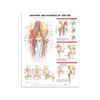 Poster - Anatomie en blessures van het heupgewricht in het Engels