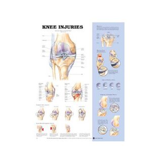 Poster knieblessures Engels
