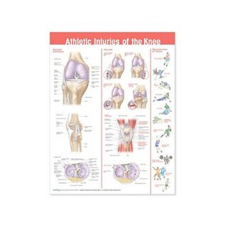 Knieblessures na sporten gelamineerde poster Engels