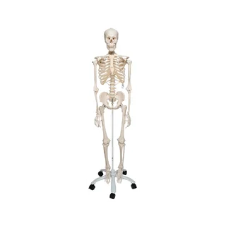 Extra robuust skeletmodel