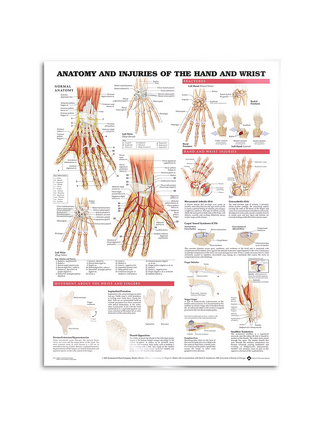 Poster - Anatomie en pathologie van de hand en pols
