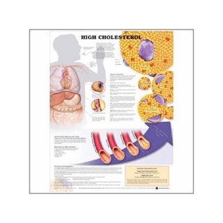 Gelamineerde poster met ringgaten voor een hoog cholesterolgehalte